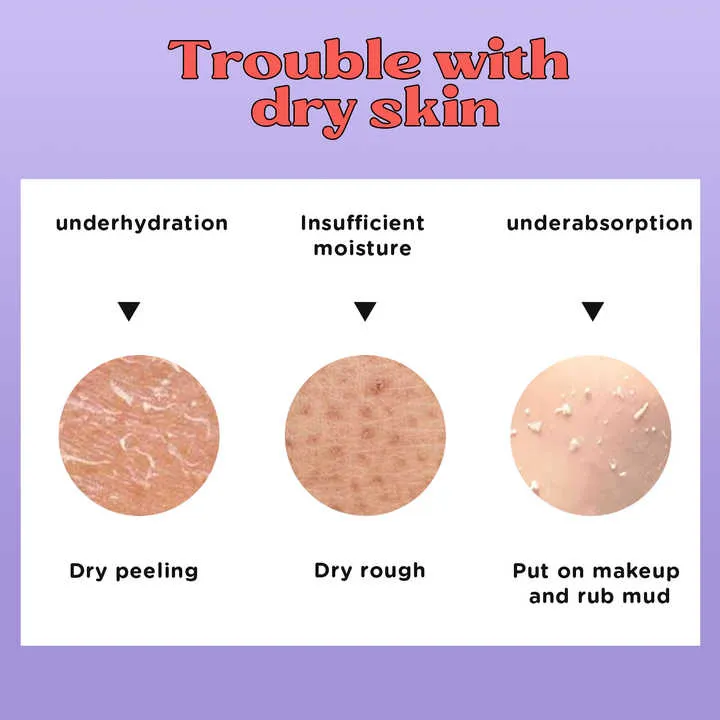 مرطب إيكوبيل الطبيعي Ecoppeal Natural Beauty