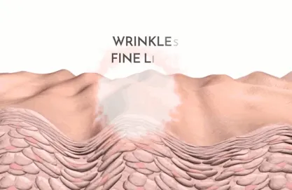 Elev Tapes - Facial Lift Japanese Tapes - Botox Alternative | Anti-Wrinkle