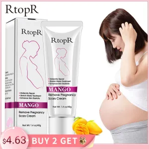 Mango Remove Pregnancy Scars Acne Cream Stretch Marks Treatment Maternity Repair Anti-Aging Anti-Winkles Firming Body Creams