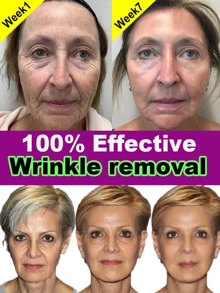 Natural repair, youthful skin reappears