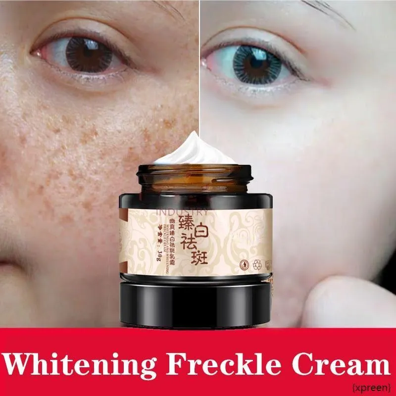 Powerful whitening freckle cream plant face cream remove freckles and dark spots 30g